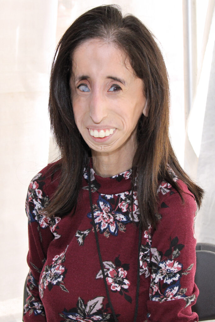 Lizzie Velasquez, on the list of famous women in history.